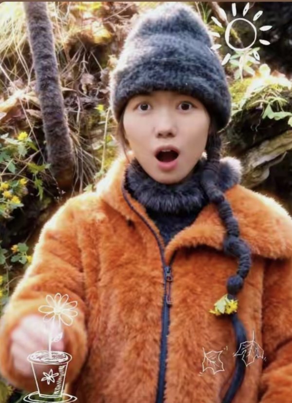 美港通证券 “荒野求生”退赛后，冷美人身体好转仍需住院静养